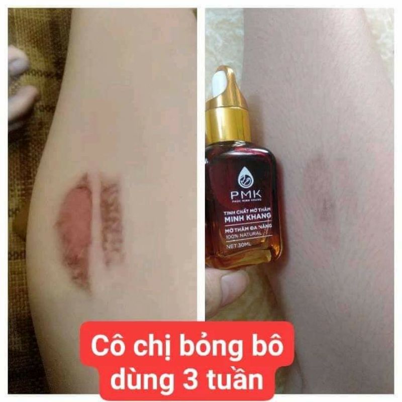 Tinh chất Xóa mờ thâm Minh Khang, Xoá thâm Sẹo,thâm mắt, thâm môi,thâm nách,thâm mụn - Chính Hãng
