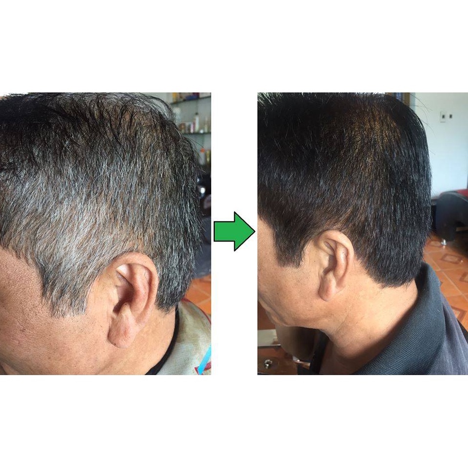 Lược Gội Phủ Bạc Từ Lá Móng Thiên Nhiên - An Toàn, Không Hoá Chất