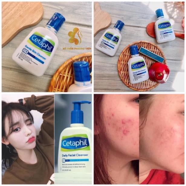 [Hàng Auth Canada] Sữa rửa mặt dịu nhẹ cho mọi loại da CETAPHIL - Gentle Skin Cleanser MADE IN CANADA 125ml | BigBuy360 - bigbuy360.vn