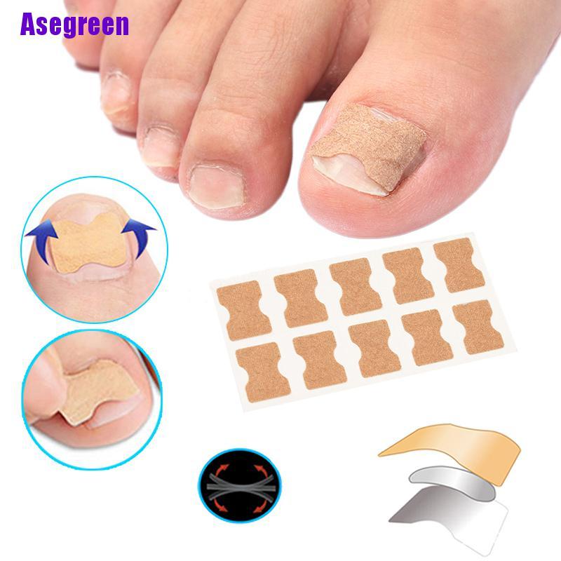 Bộ Điều Chỉnh Kích Thích Mọc Móng Lưng Tiện Lợi
