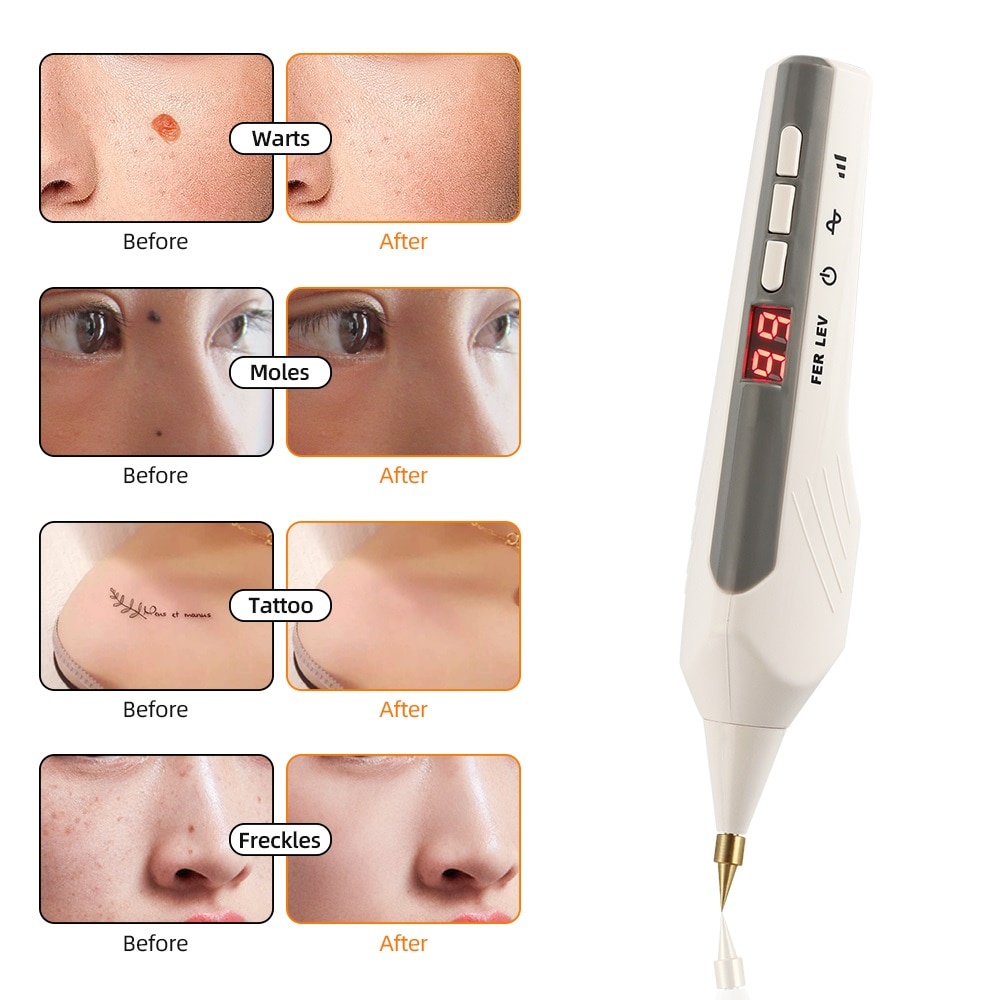 Foreverlily Mãi mãi  Bút Laser 9 Cấp Độ Có Thể Sạc Lại Dùng Hỗ trợ giảm tàn nhang Đốm Đen Và Tàn Nhang