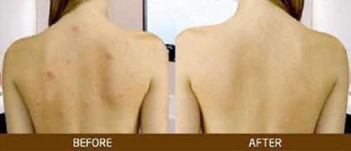 Sữa tắm aderma hỗ trợ giảm mụn lưng ,thu nhỏ lỗ chân lông trên cơ thể 500ml mẩu mới 2021 Van maison | BigBuy360 - bigbuy360.vn