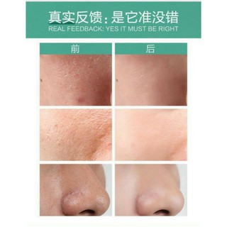 serum se khít lỗ chân lông zenshow