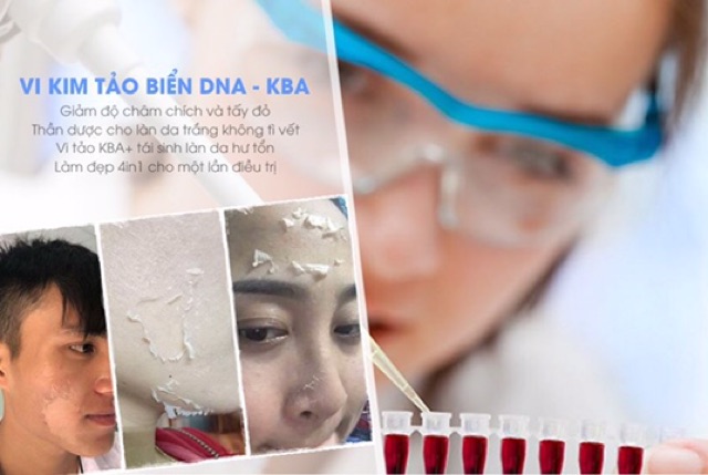 Vi kim tảo biển DNA cá hồi KBA+