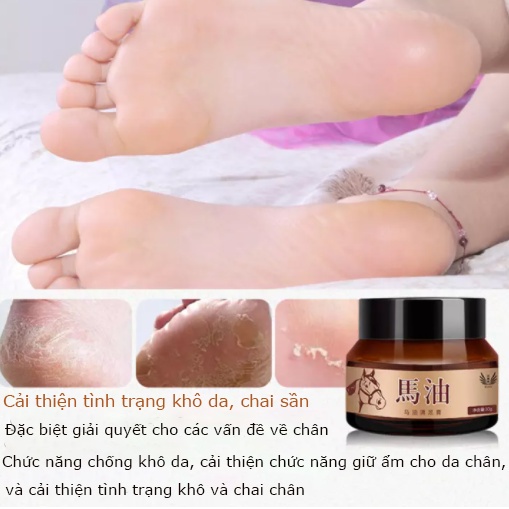 Kem Dưỡng Chân Dầu Ngựa, Giảm Nứt Nẻ Gót Chân, Tay, Loại Bỏ Tế Bào Chết, Dưỡng Ẩm Chân Tay Mịn Màng