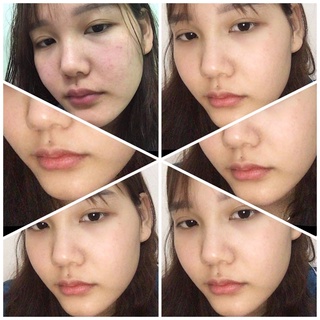 Thảo Mộc Xanh Serum ❗Free Ship