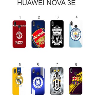 Ốp lưng huawei nova 3e dẻo in hình câu lạc bộ m2