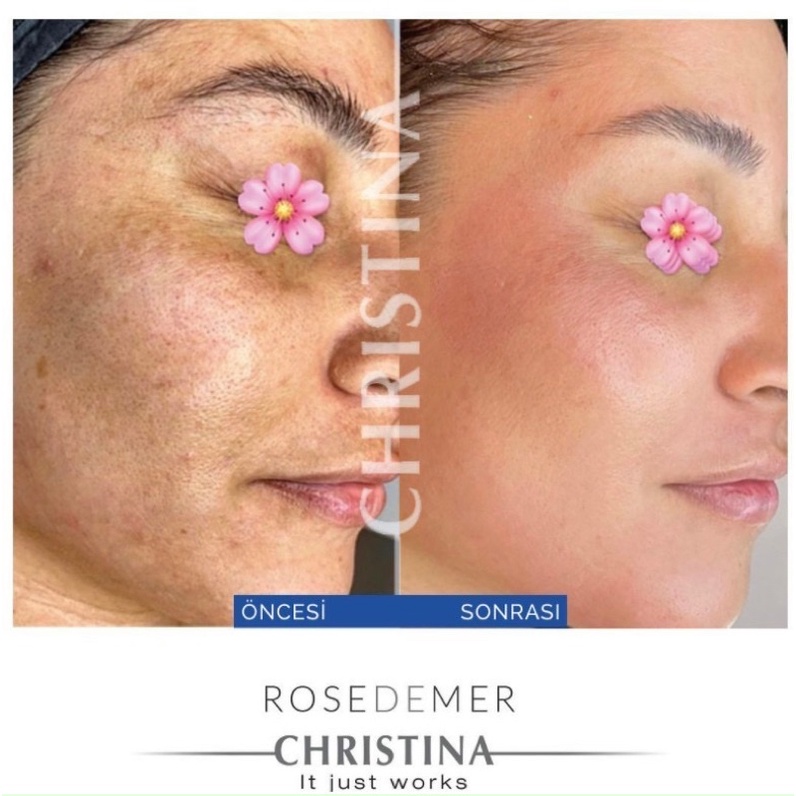 TEM CTY CHRISTINA ROSE DE MER PEEL - PEEL TÁI TẠO DA TỪ SAN HÔ VÀ SINH VẬT BIỂN