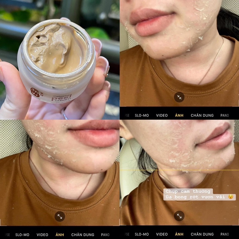 Feel Thay Da Mới Tảo Sâm MEEA - Tái Tạo Không Sưng Đỏ Da.