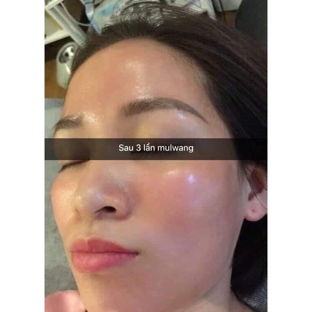 Serum căng bóng Mulwang X5 nguyên lọ