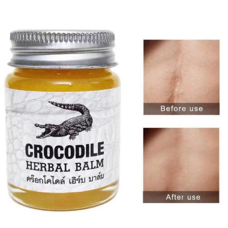 Kem mờ sẹo mờ thâm Cá Sấu Thái Lan Crocodile Herbal Balm 30g