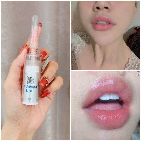 Kem Làm Hồng Môi Nuwhite L1a, Kem Khử Thâm Môi Biowhite Prudente Professional 5ml Cải Thiện Sắc Tố Dưỡng Môi