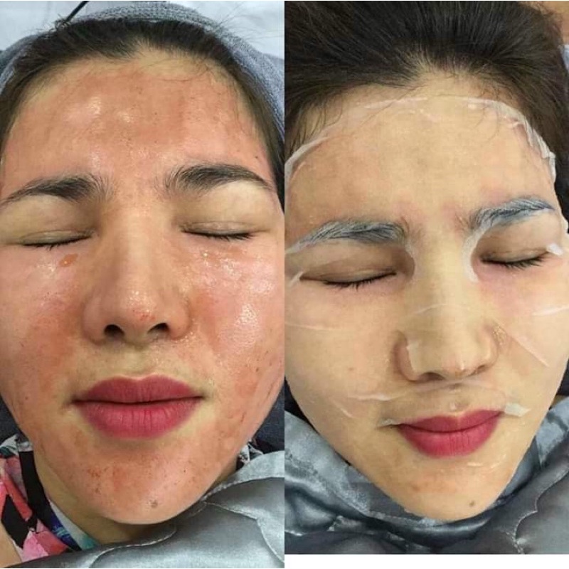 MẶT NẠ SMAS PEPTIDE SILK MASK 24H HYDRATION BOOST 25G