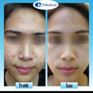 Sữa rửa mặt Medicos Deep Cleanser