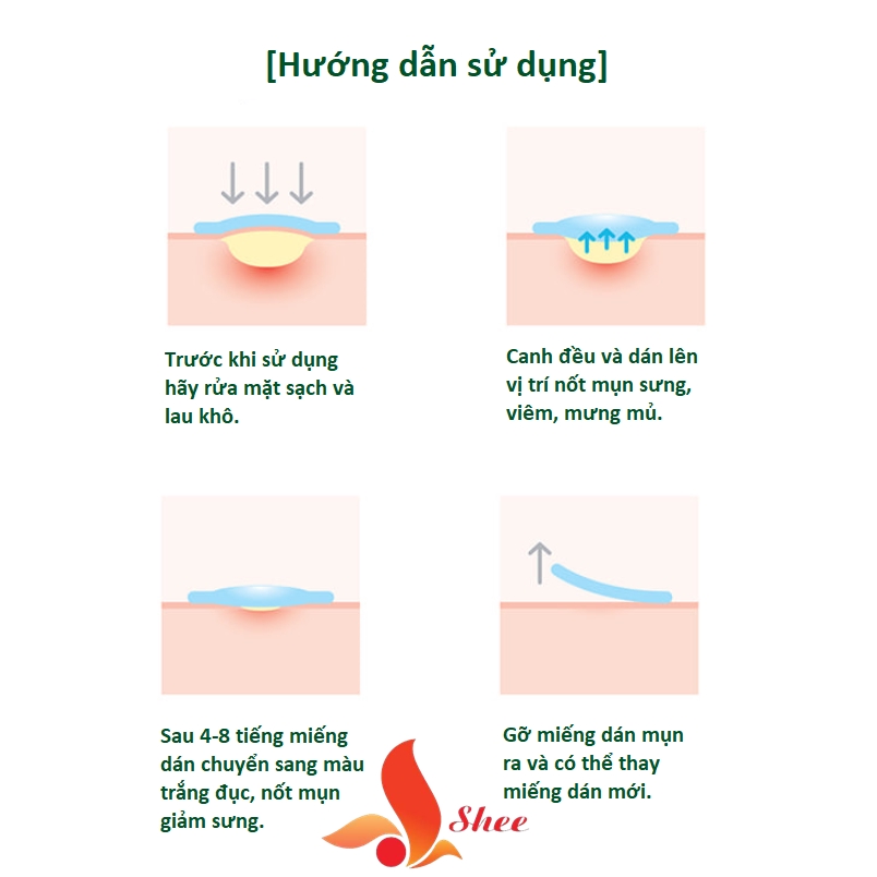 Miếng dán mụn Some By Mi Clear Spot Patch