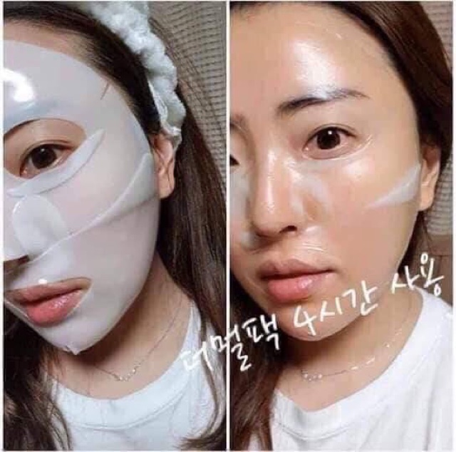 Mặt nạ Derm-all Matrix mẫu mới