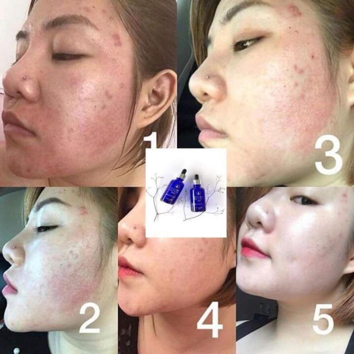 Serum HA cấp ẩm căng bóng da Genie 100ML