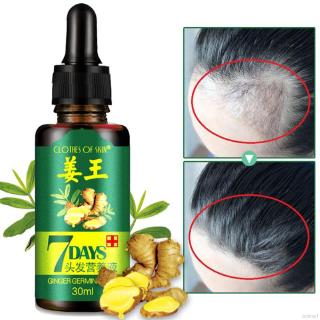 [Hàng mới về] Serum trị liệu dưỡng và chống rụng tóc tinh chất gừng