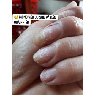 Dưỡng móng Eveline 8in1 [ Chính hãng ]