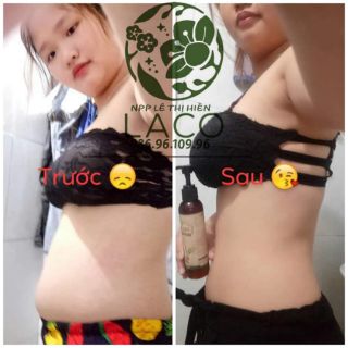 GEL TAM MỠ DELIM