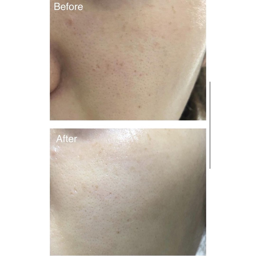 Mặt Nạ Luvum Real Calmingpair Cicadrogel MaskPack