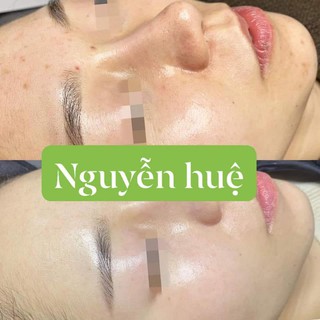 Peel Lacto onmacabim sáng mịn da 30ml