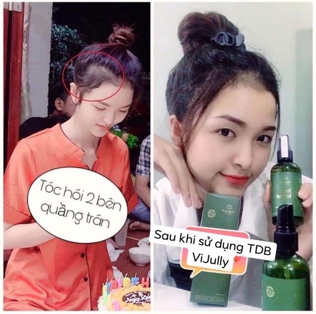 [chính hãng] Xịt bưởi Vijully kích thích mọc tóc dài dày