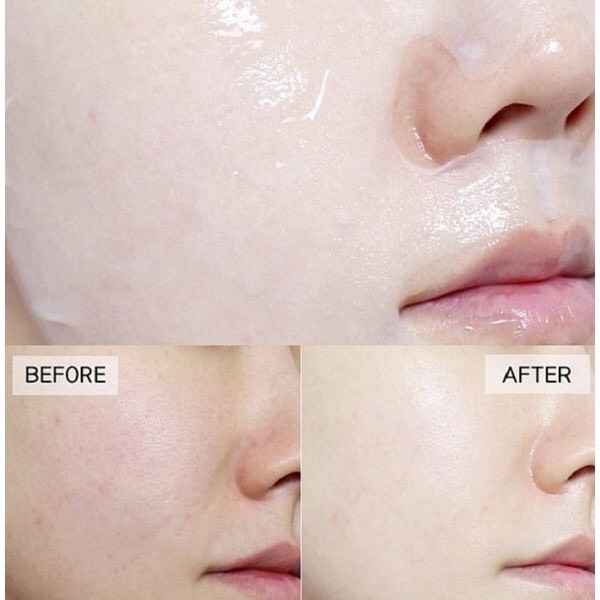 Mặt nạ miếng dưỡng ẩm, dưỡng trắng, giảm mụn, phục hồi da Hàn Quốc BNBG Mask