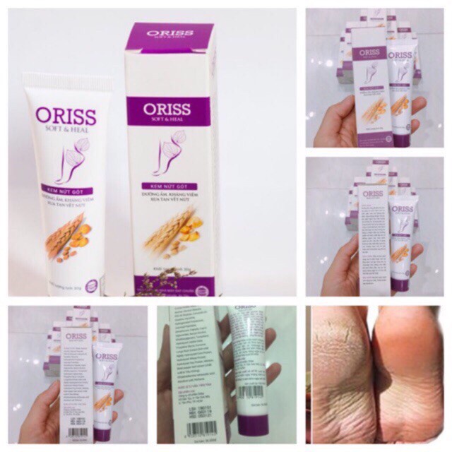 Kem Nứt Gót Oriss Soft And Heal 30G