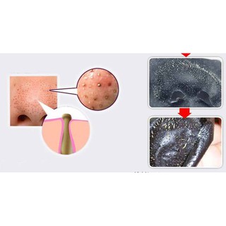 Gel lột mụn Namo