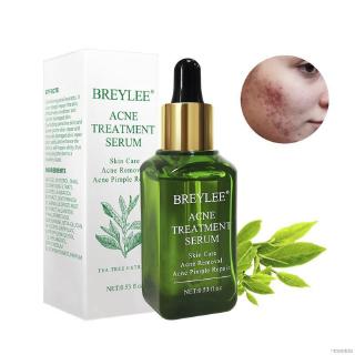 [Hàng mới về] Serum Hỗ Trợ Giảm mụn loại bỏ sẹo dưỡng ẩm da mặt 15ml