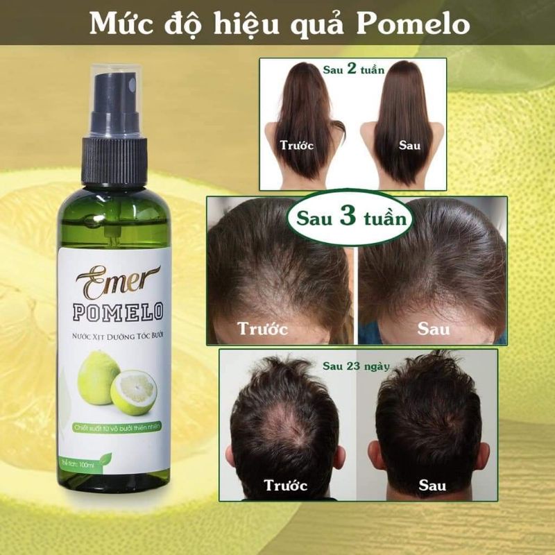 Tinh dầu bưởi xịt mọc tóc Pomelo Emer 100ml giúp giảm rụng tóc, kích mọc tóc nhanh cho mái tóc dày và dài