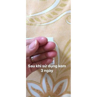 Kem dưỡng da đa năng Glysolid nội địa Đức