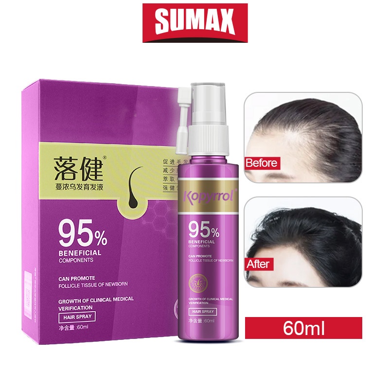 Serum mọc tóc cho phụ nữ SUMAX 60ML
