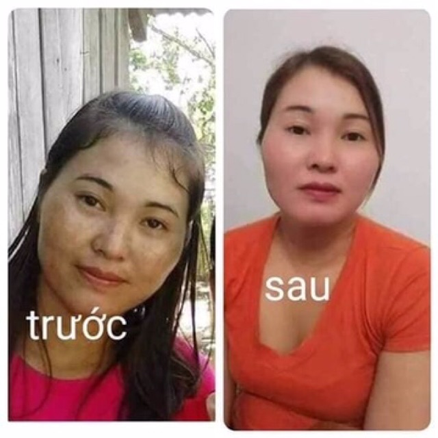 Kem dưỡng trắng da whitening  25g