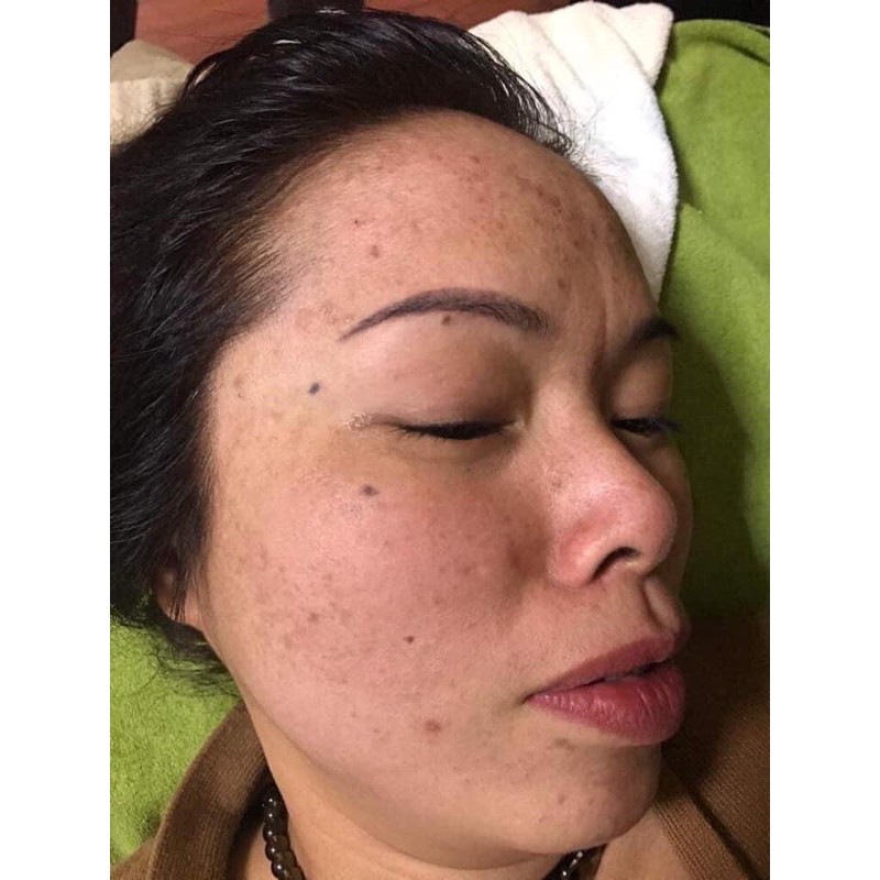 Detox Skin mẫu mới 2021 | BigBuy360 - bigbuy360.vn