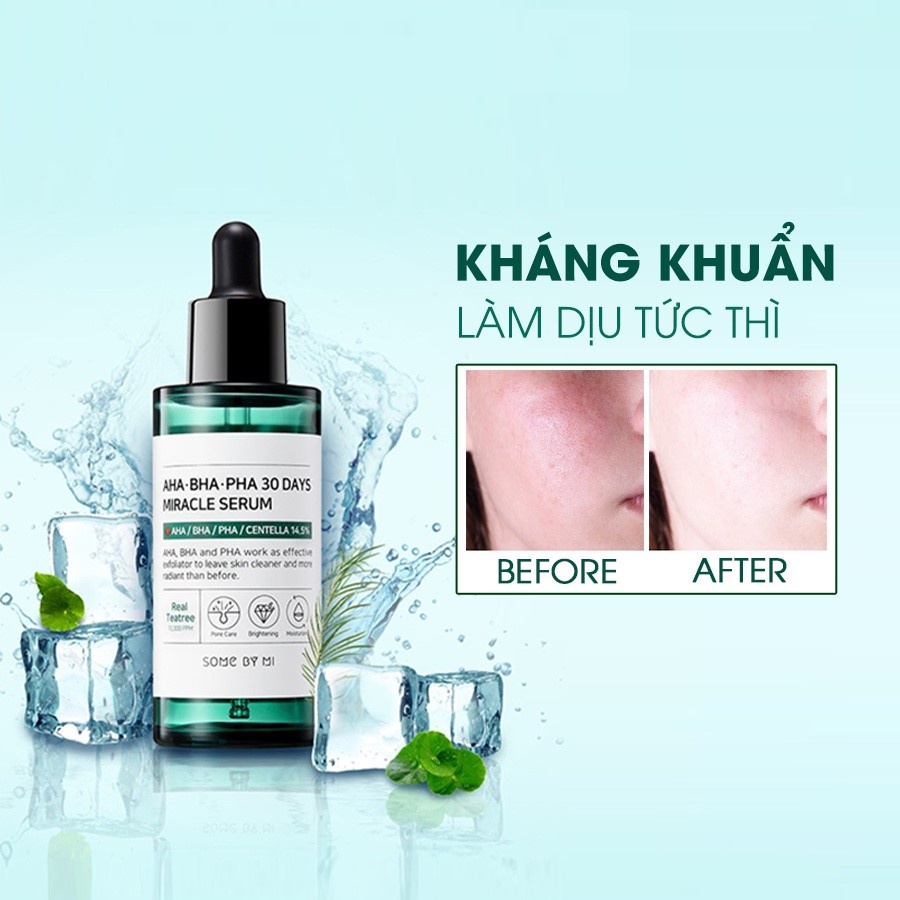 Tinh chất Serum và nước hoa hồng Some By Mi AHA-BHA-PHA 30 Days Miracle Serum Hàn Quốc | BigBuy360 - bigbuy360.vn