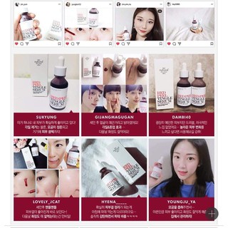 Thay da sinh học RED PEEL TINGLE SERUM