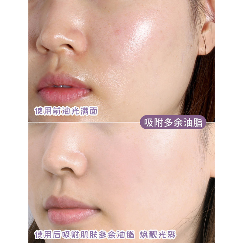 [Hàng mới về] Mặt nạ trà xanh MENGSIQI tẩy mụn trứng cá điều dầu thanh lọc trên da hiệu quả