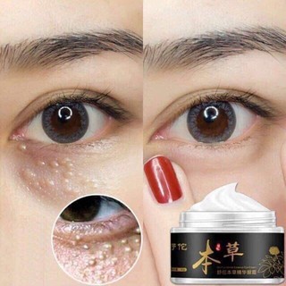 Kem tri mụn thịt đông y