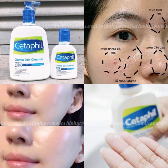 Sữa Rửa Mặt Cetaphil