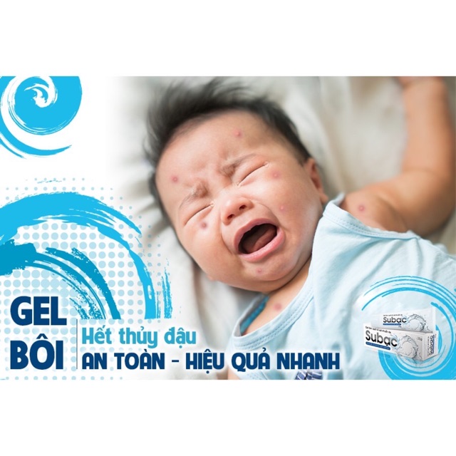 Su bạc - Subac giải pháp cho bệnh thuỷ đậu, zona