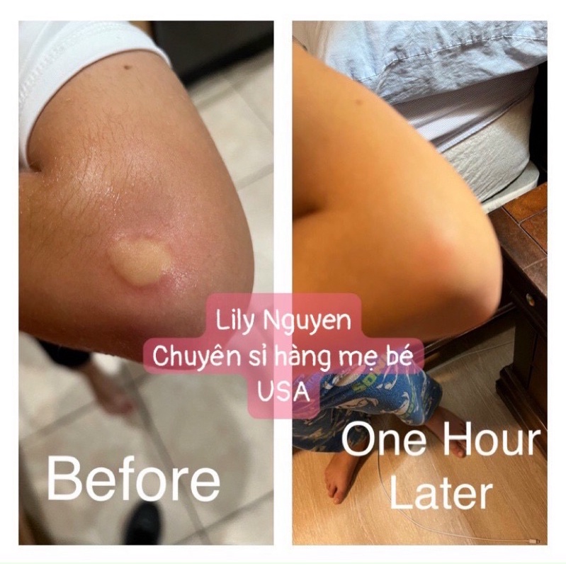 XỊT MEN VI SINH , LỢI KHUẨN CHO BÉ BABYBIOTICS 120ML MẪU MỚI NHẤT  - BAABEELAND