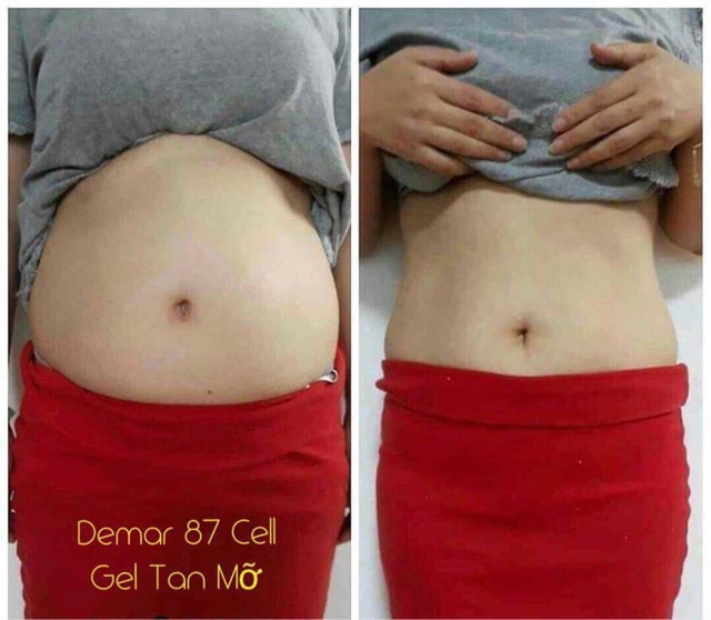 Gel tan mỡ Derma Cell Hàn Quốc tặng quần lót định hình | BigBuy360 - bigbuy360.vn