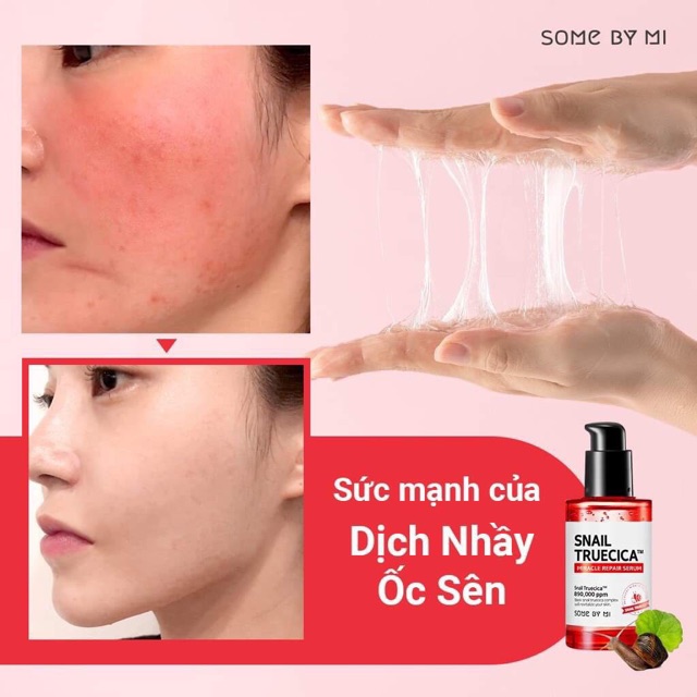 Some By Mi / Phân Phối Chính Hãng /Tinh chất Snail Some By Mi Truecica Mircle Repair