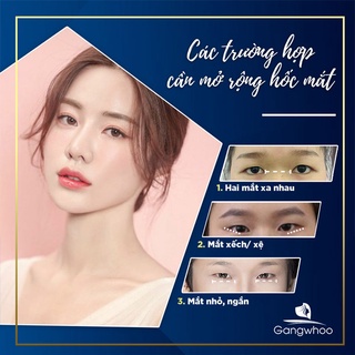 Dịch vụ Tạo hình góc mắt tại Gangwhoo