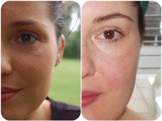 Insta Natural Skin Brightening Serum