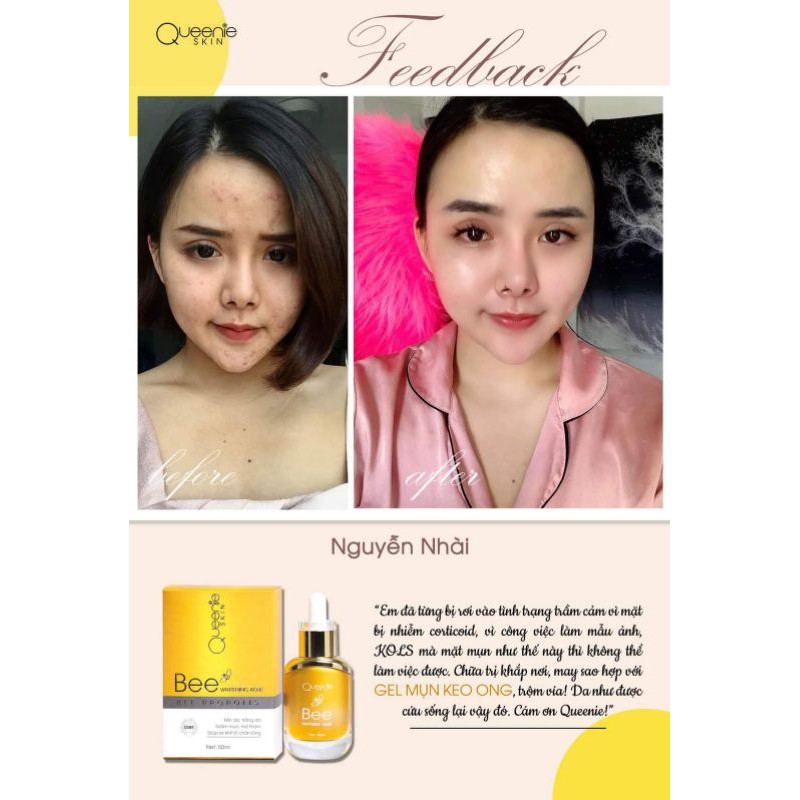 Gel Mụn Keo Ong 50ml 'BEE WHITENING ACNE' CÔNG TY DƯỢC MỸ PHẪM QUEENIE SKIN