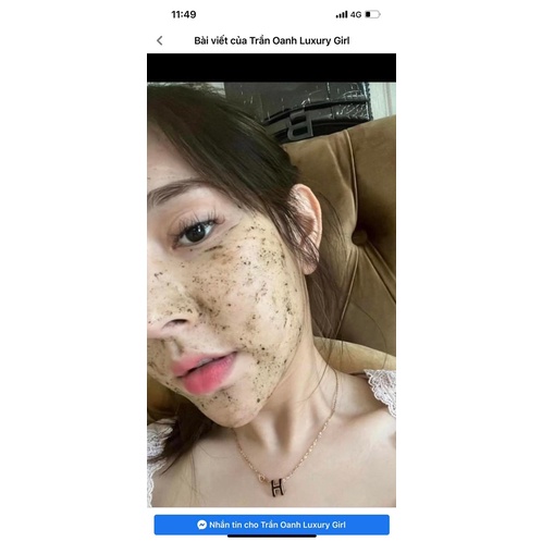 PEEL VI TẢO LỌ 10ml