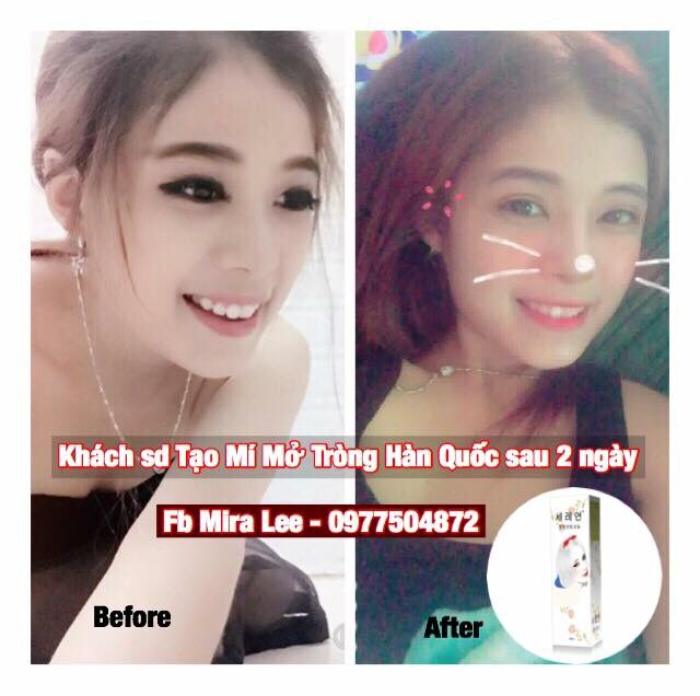 Tinh Chất Tạo Mắt 2 Mí Miracle